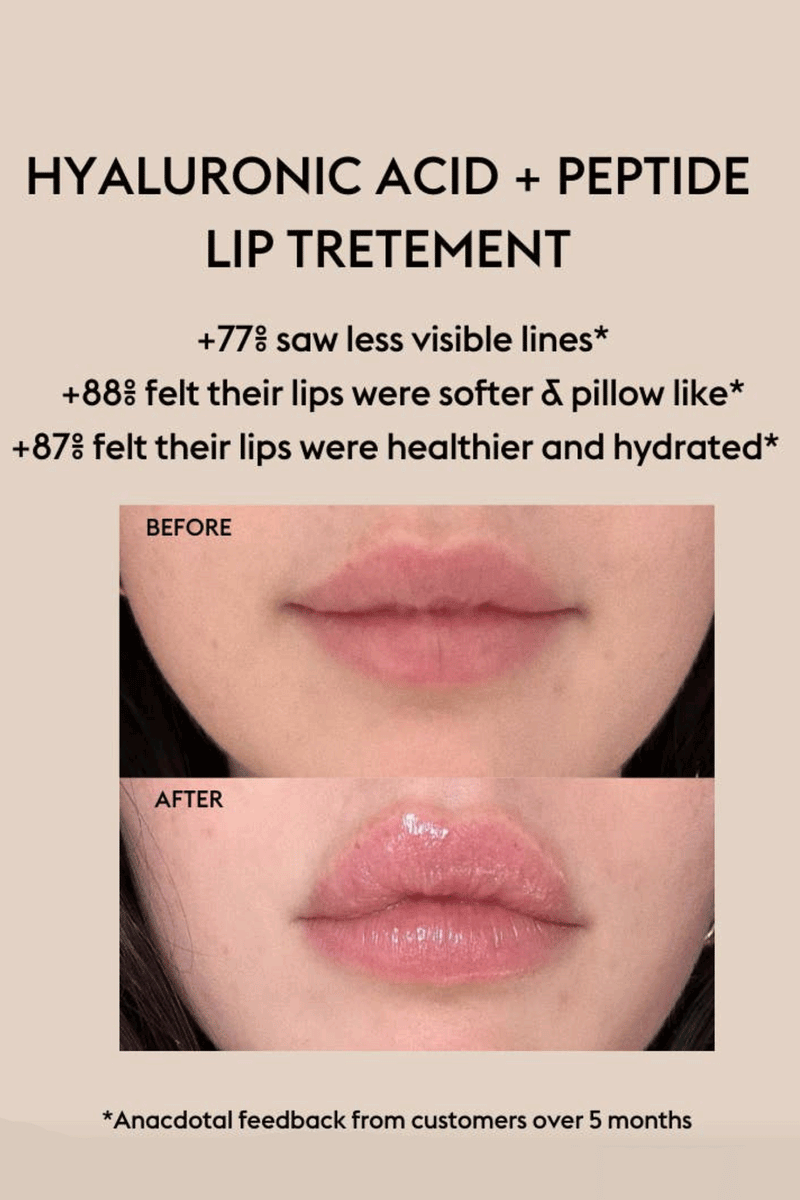 Hyaluronic acid lip balm discount